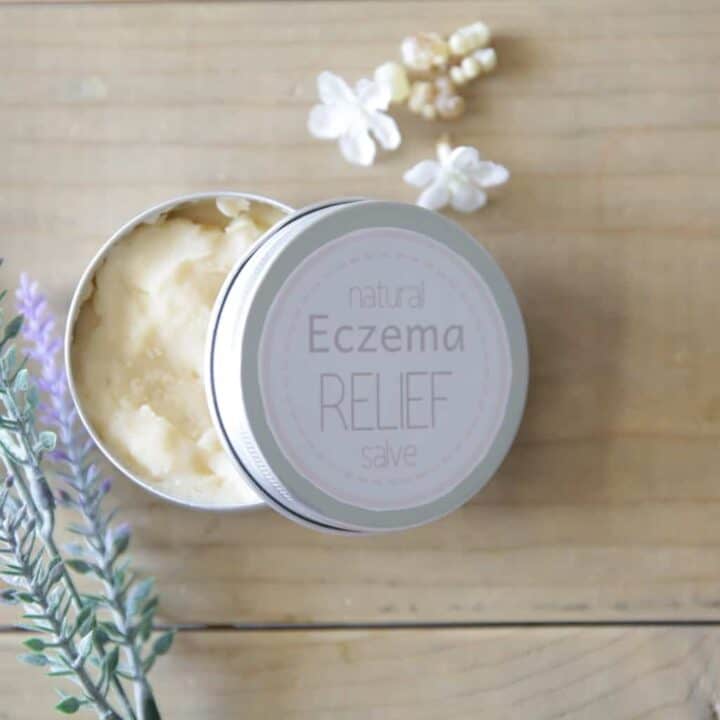 Homemade Soothing Eczema Salve-image