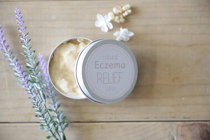 Homemade Soothing Eczema Salve