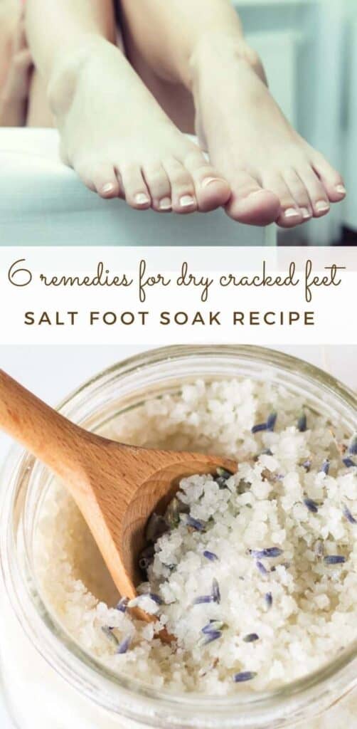 Diy foot scrub for dry cracked feet store