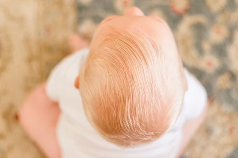 Top of baby's head after getting cradle cap brushed out.