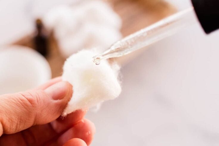 Adding drops of witch hazel and tree tea to help with an ingrown hair.