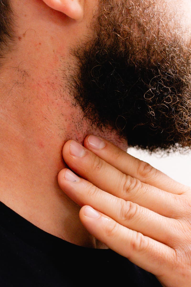 Applying pre shave oil to the underside of the beard in preparation of shaving.